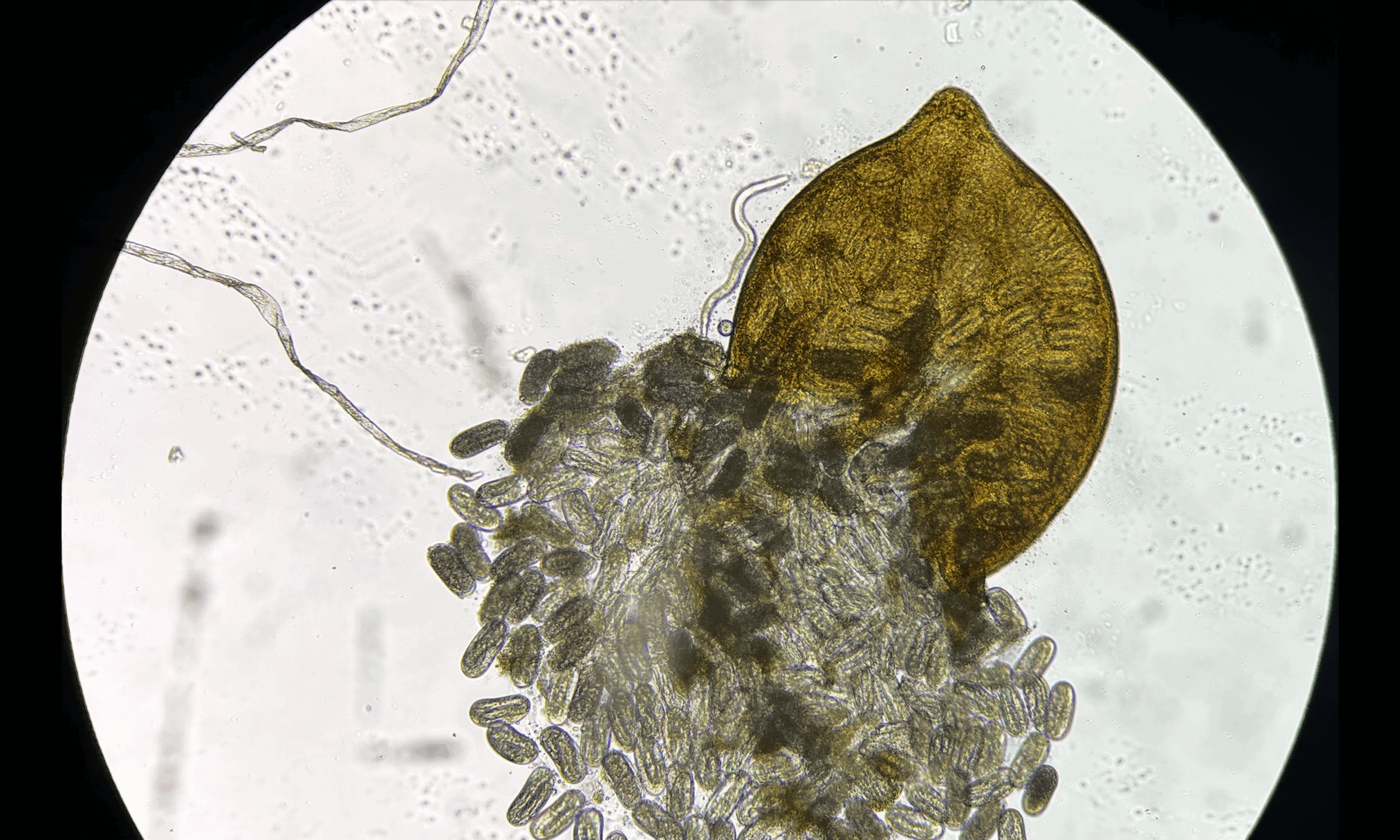 A microscope close up shows a yellow soybean cyst releasing small nematode eggs