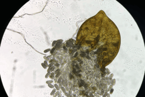 A microscope close up shows a yellow soybean cyst releasing small nematode eggs