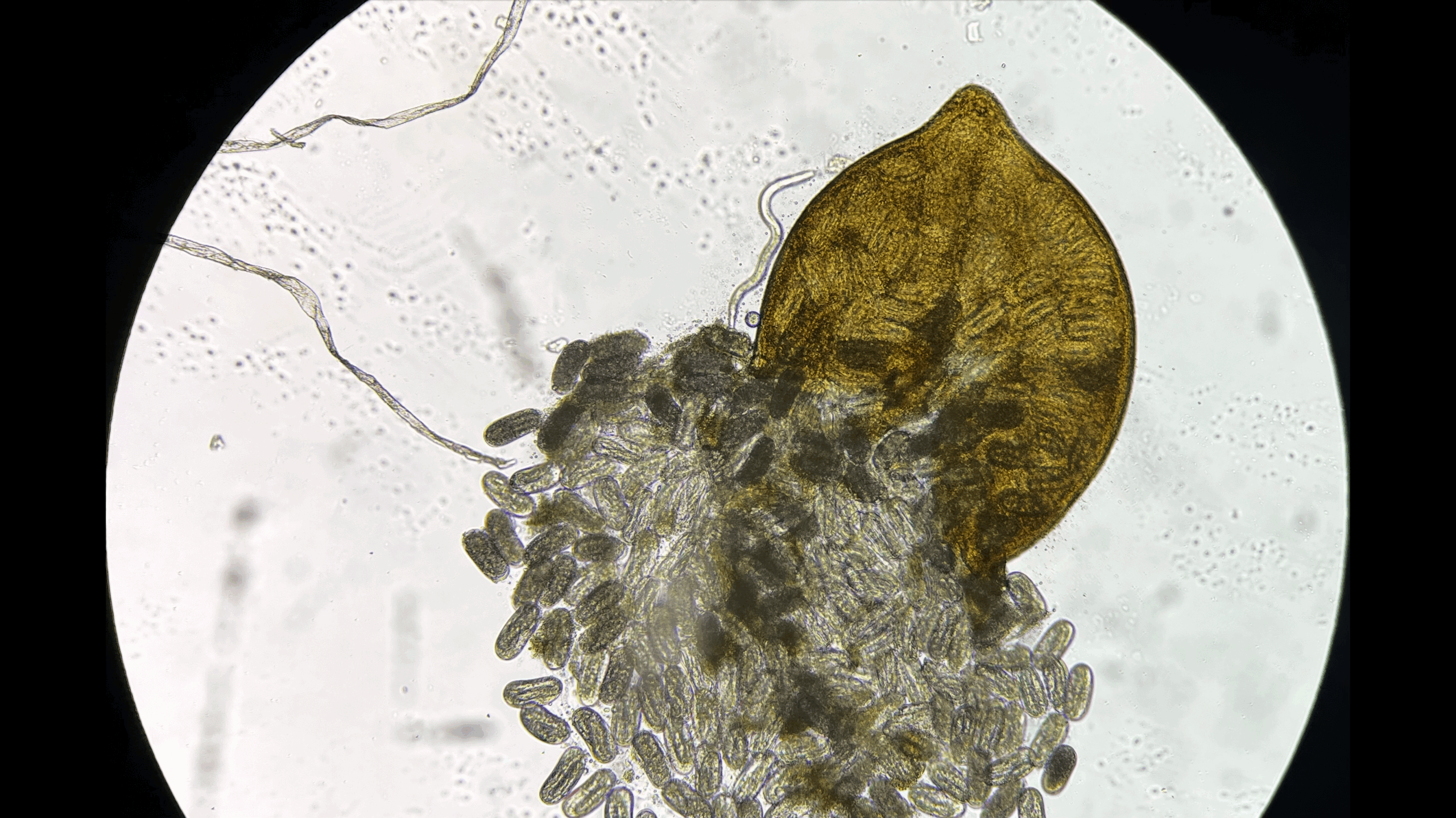 A microscope close up shows a yellow soybean cyst releasing small nematode eggs